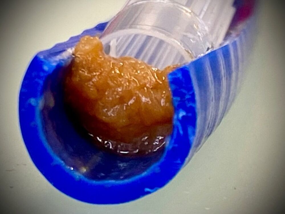 … besiedeln Biofilme auf Materialien, …